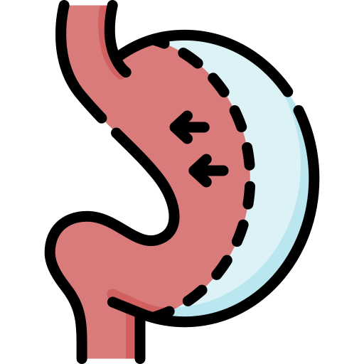 bariatric-surgery (1)